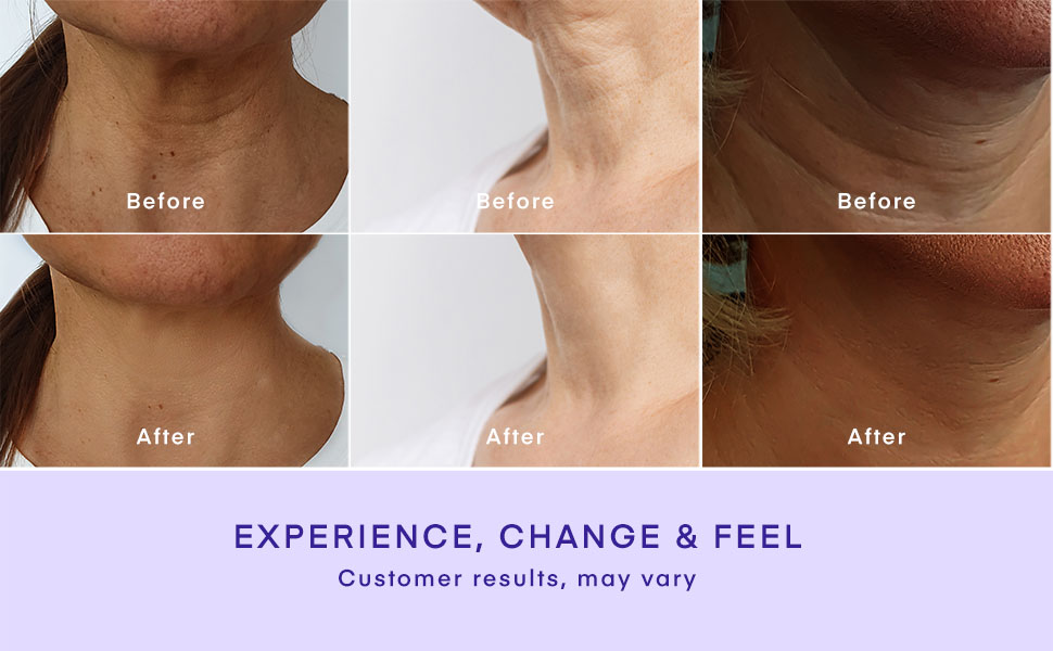 tighten and lift neck cream