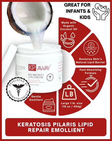 KPAway Infographic