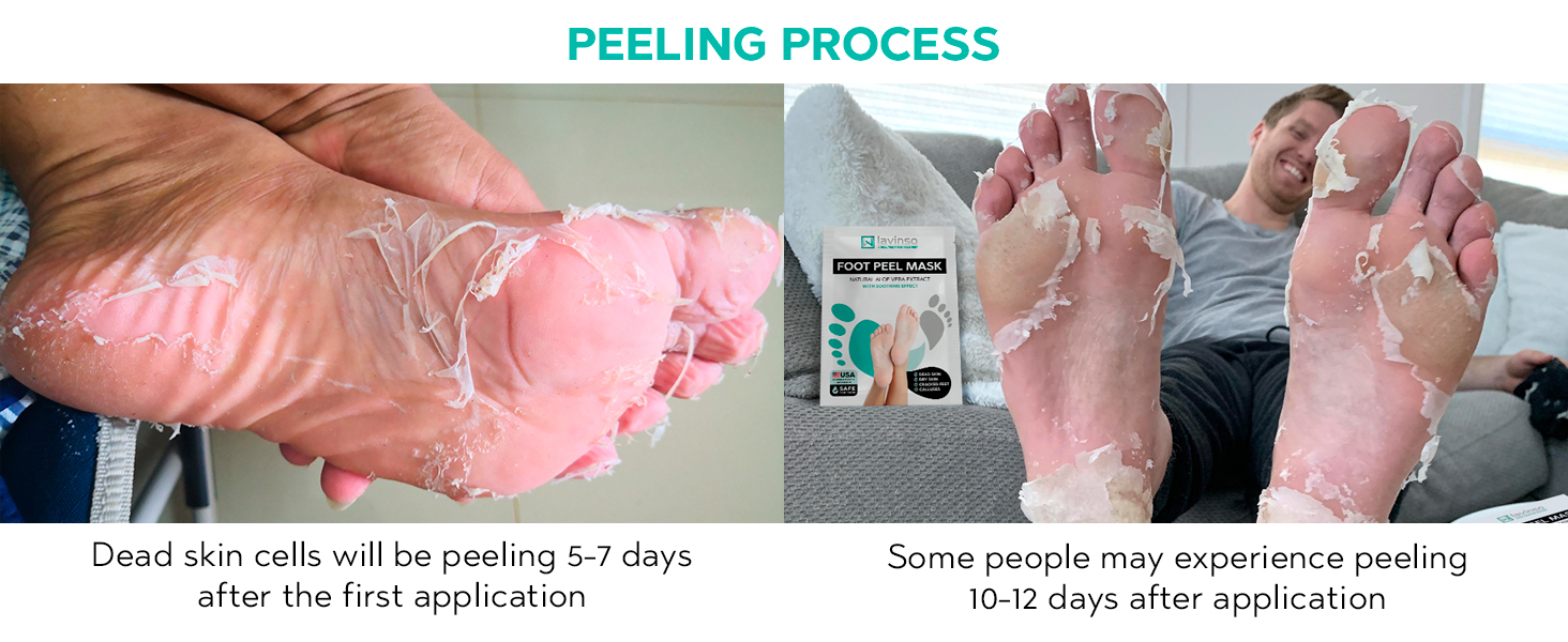 foot mask for dry cracked feet