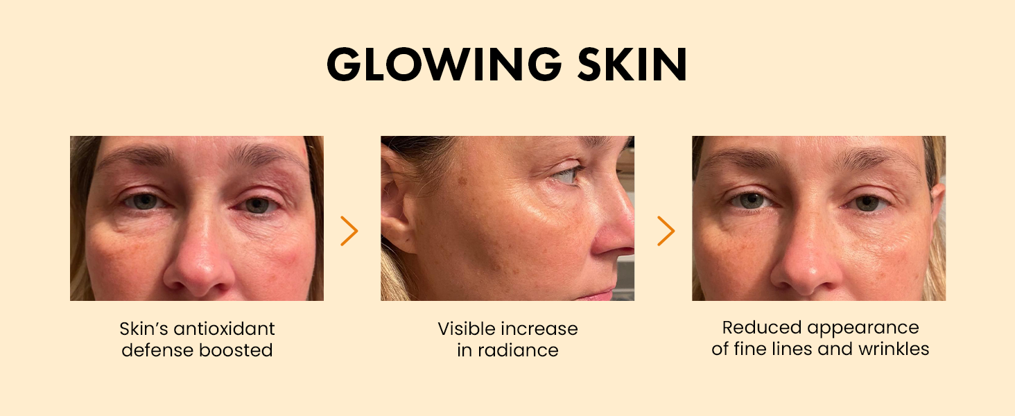 vitamin c serum