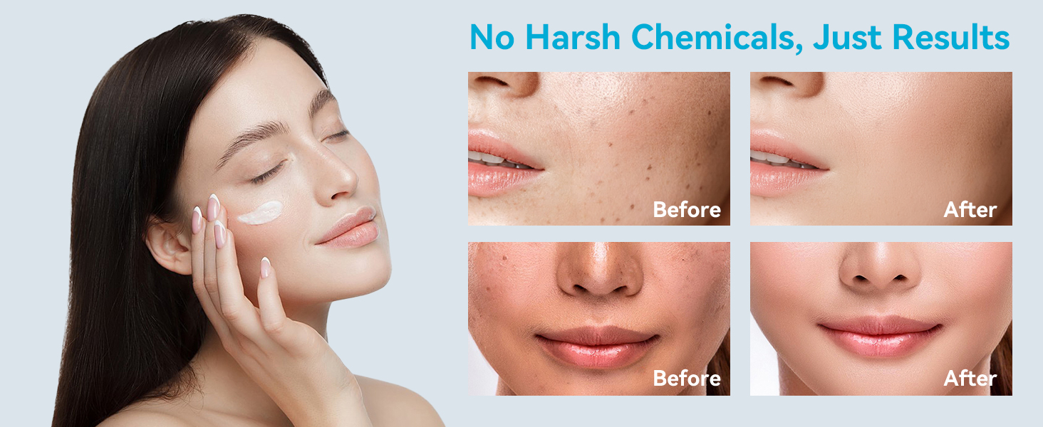 Brown Spot Cream