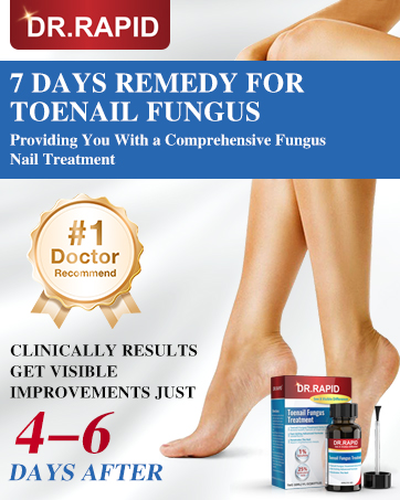 toenail fungus treatment extra strength nail fungus treatment extra strength