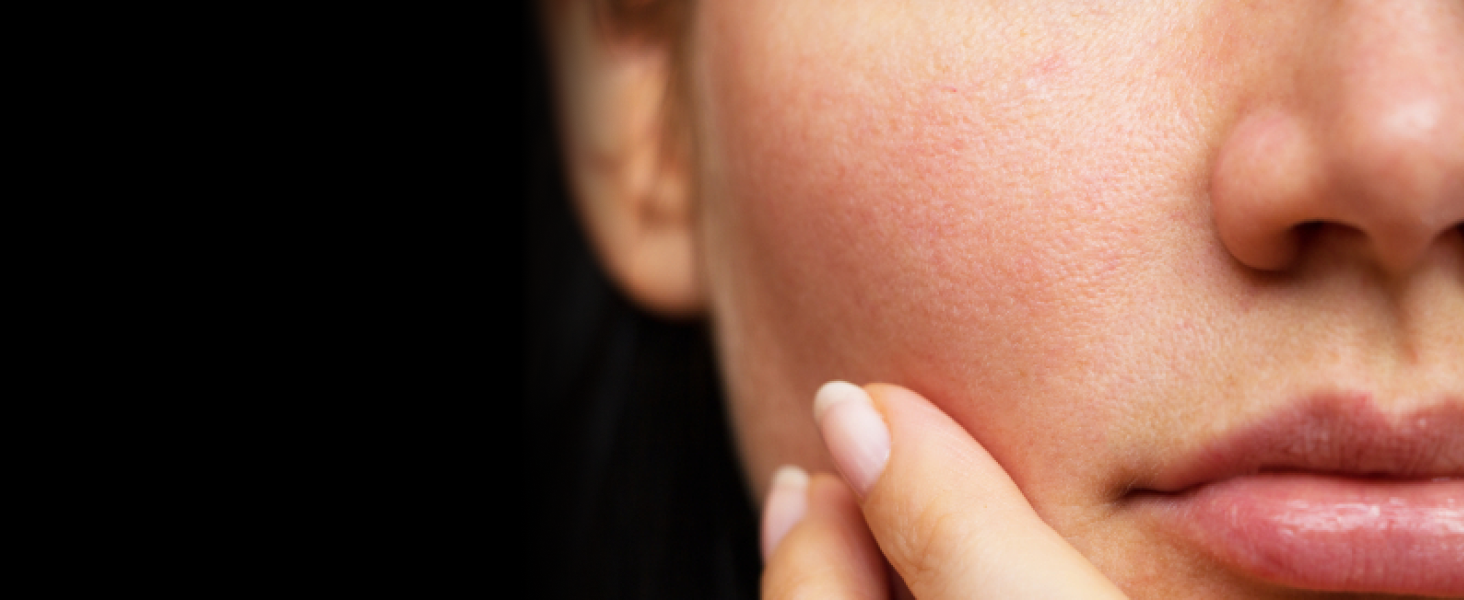 Dermatoligist recommended
