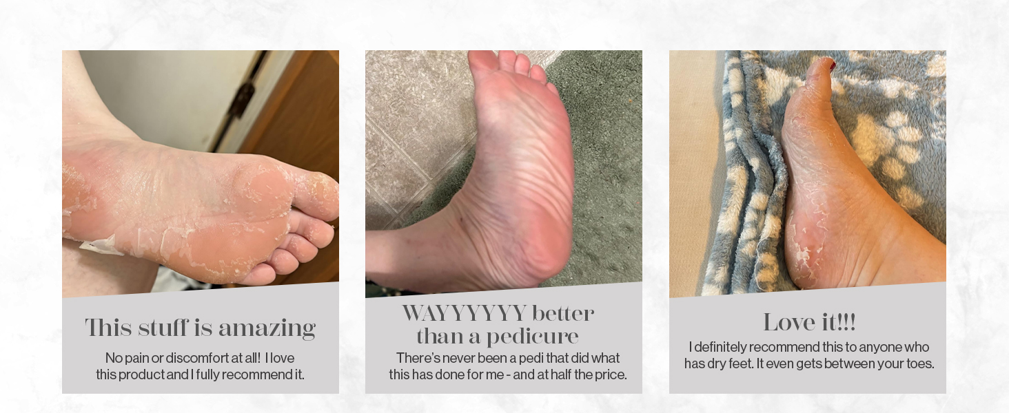 extremely blade pedi box trooper healthy deep cooling soap calusses therapy severe callace spa