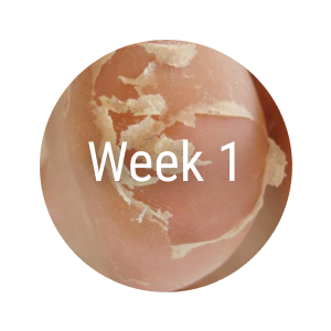 Exfoliation Foot  Peel for Men