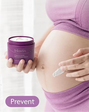 Stretch Mark Care that Works
