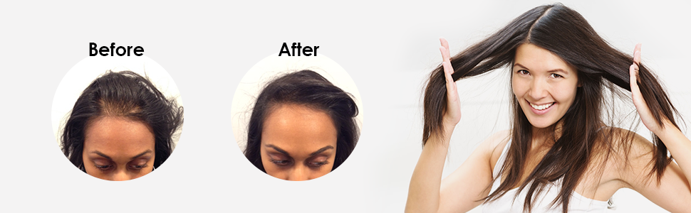 sai zen, anti thinning, anti aging, hair loss, treatment, hair thinning, DHT, cancer, volume 