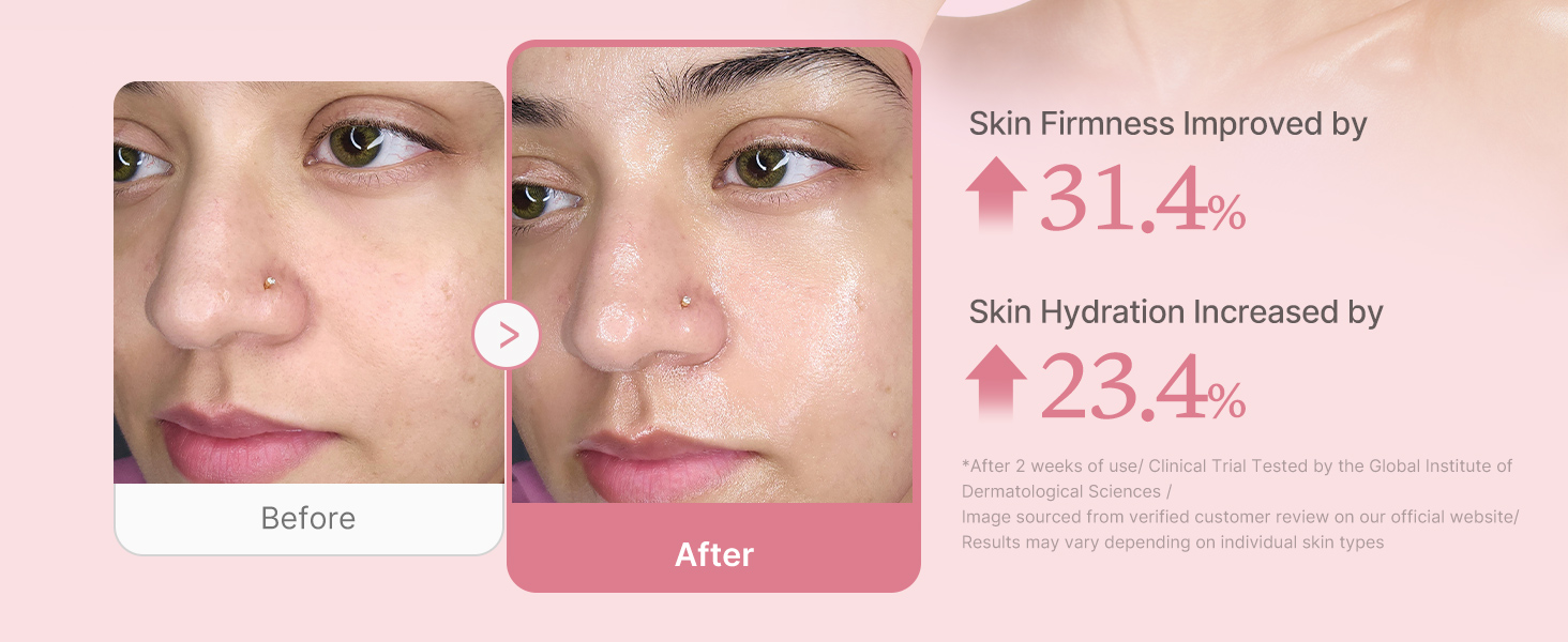 collagen