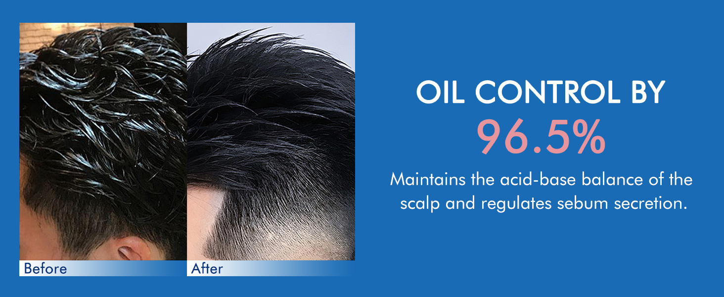 Ceson&amp;amp;Cesun Folliculitis, Seborrheic Dermatitis Shampoo