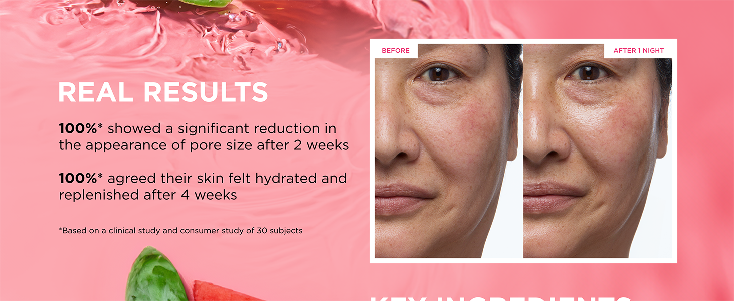 Watermelon pore-tight toner hydration for dry skin