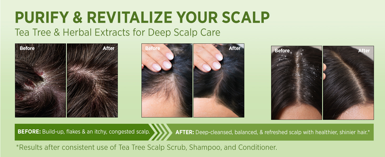tea tree scalp scrub