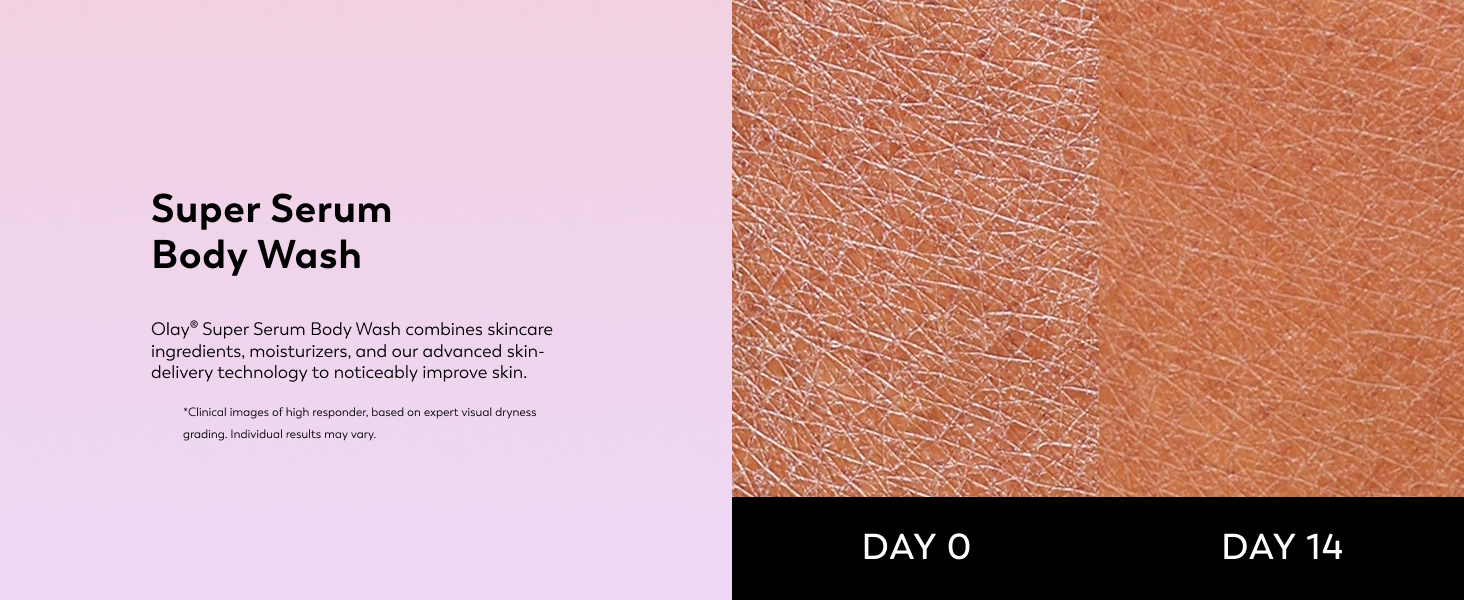 Skin Comparison 