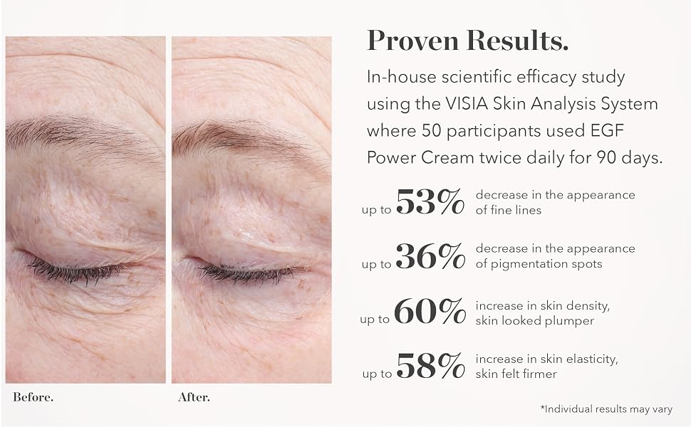 Proven Results in-house scientific efficacy study where 50 participants used EGF Power Cream 90 days