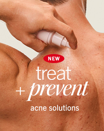 Brand Story - Acne