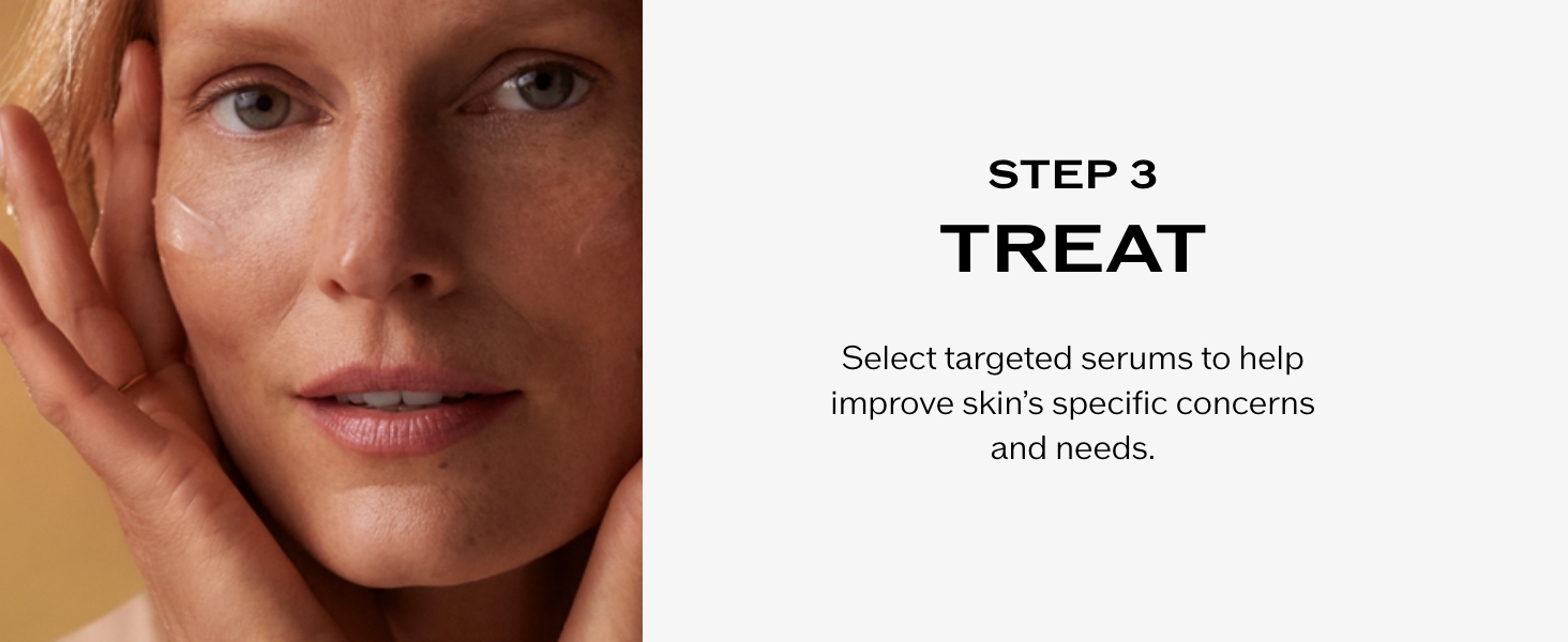 Step 3 - Treat