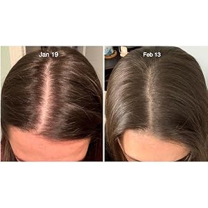 Hair loss growth regrowth dht blocker block thin thinning stimulate women men bald balding