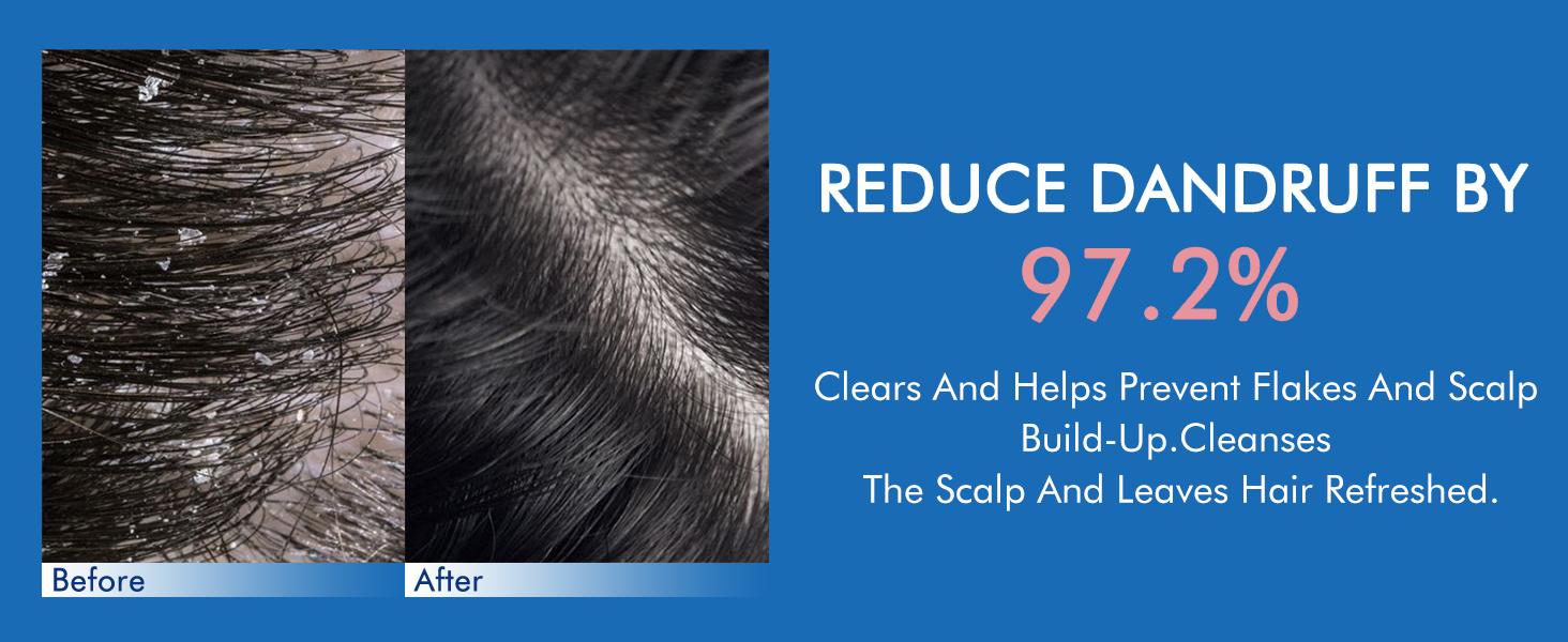 Ceson&amp;amp;Cesun Folliculitis, Seborrheic Dermatitis Shampoo