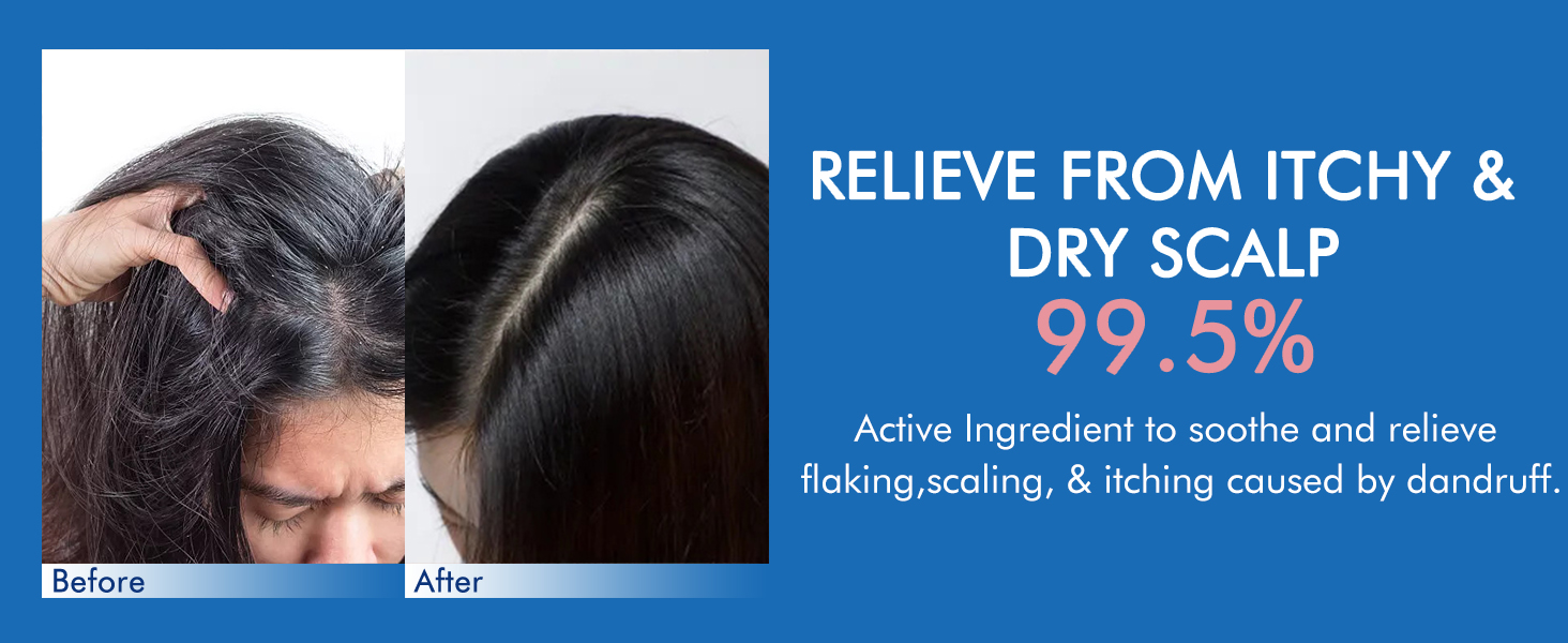 Ceson&amp;amp;amp;Cesun Folliculitis, Seborrheic Dermatitis Shampoo